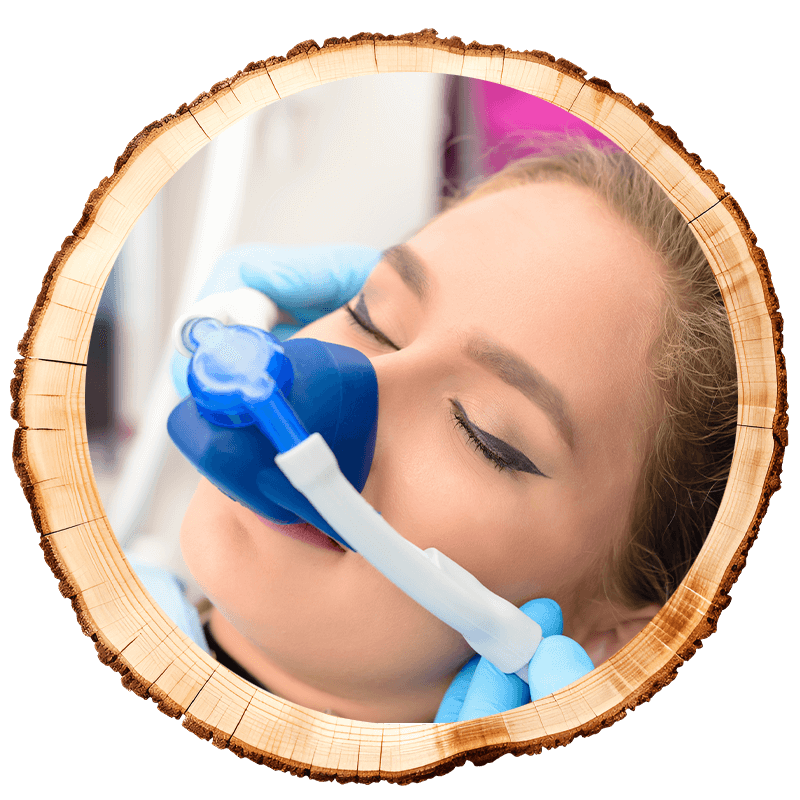 sedation patient during nitrous oxide
