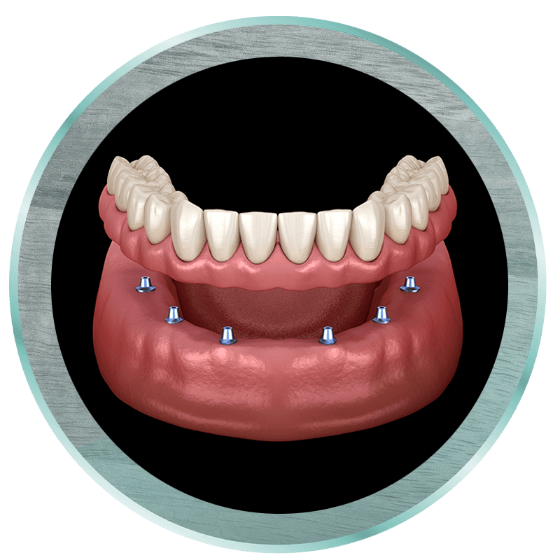 denture