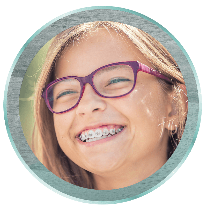 traditional braces